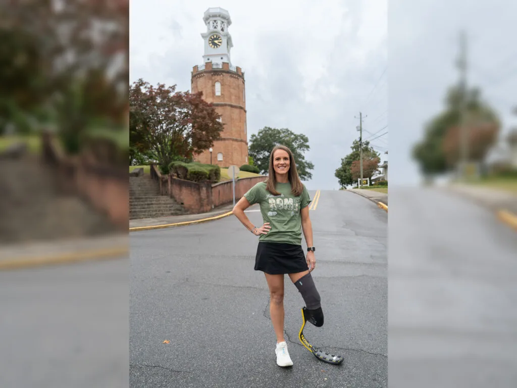Hannah Nabors preparing to run with prosthetic running blade